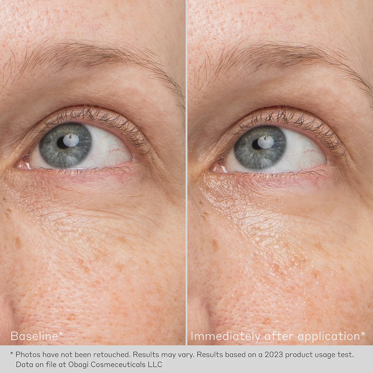 OB-DHD-EYE-BEFORE-AND-AFTER-1260X1260-009_5_1440x.jpg