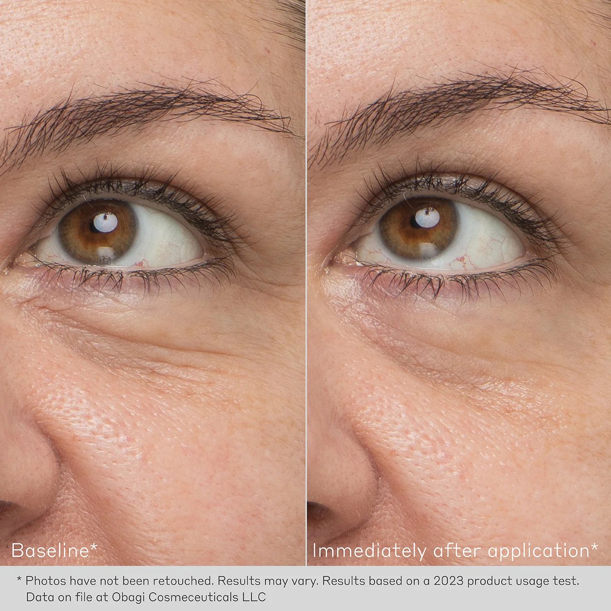 OB-DHD-EYE-BEFORE-AND-AFTER-1260X1260-013_2_1440x.jpg